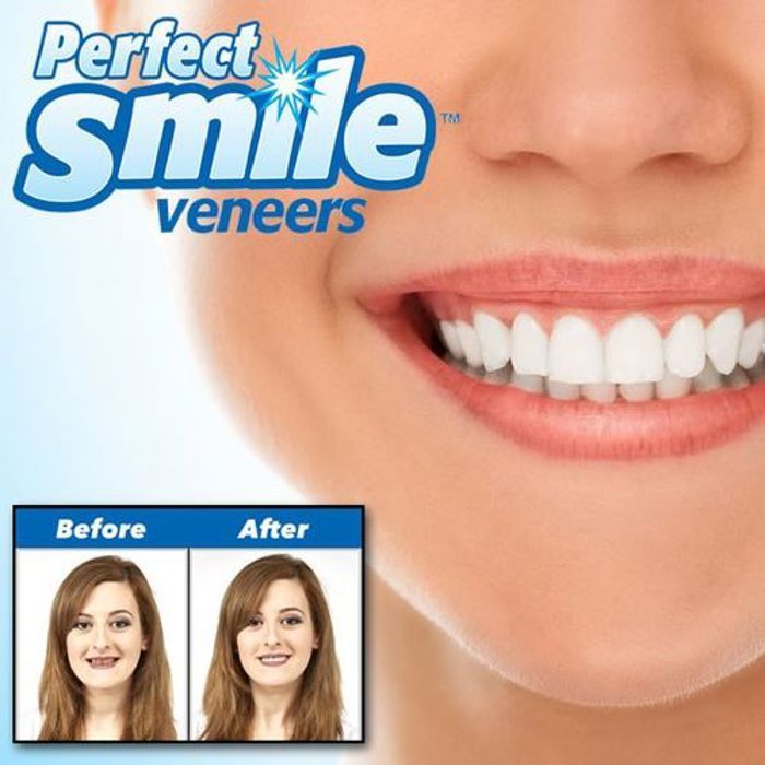 Perfect Smile veneers- Smile Fit Flex Dents Silicone