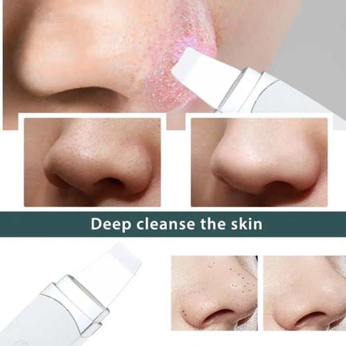 Ultrasonic Hailicare-Machine à éplucher à ultrasons, soins de la peau,  pour le visage