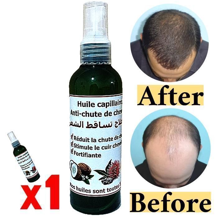 Pack Soin capillaire huile anti chute cheveux: Ricin Coco sésame 100ml