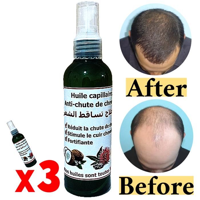 Pack Soin capillaire huile anti chute cheveux: Ricin Coco sésame 300ml