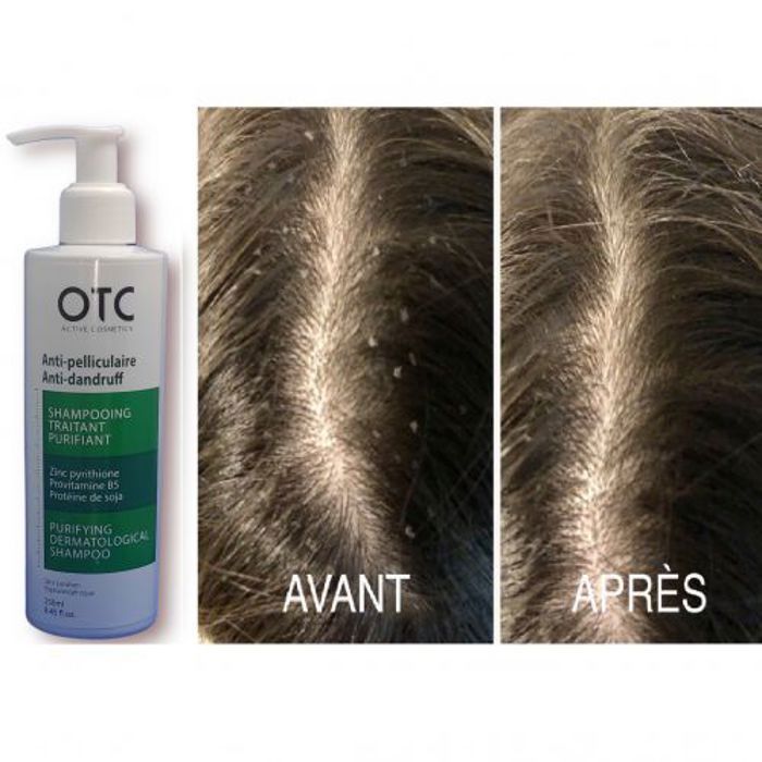 Shampoing Anti-Pelliculaire puifiant sans paraben Hypoallergénique 250ml
