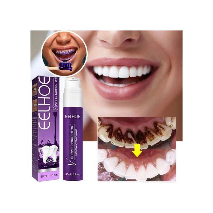 Mousse Blanchissante 50ml - Nettoyage en Profondeur, Rafraîchissant et Élimination de la Plaque