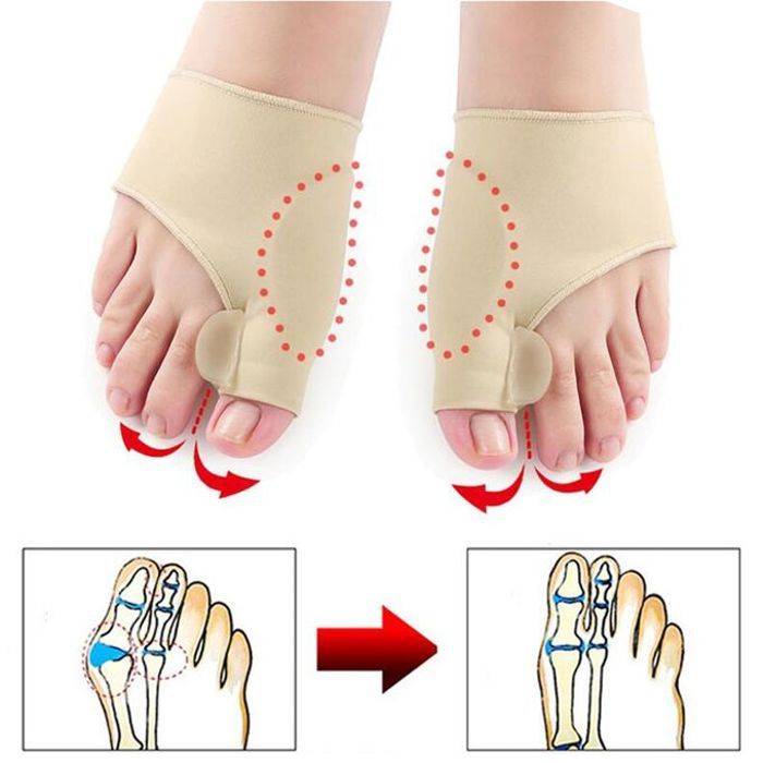 Séparateur d'orteils, correcteur d'hallux Valgus, Soulagement de la douleur, 1 paire