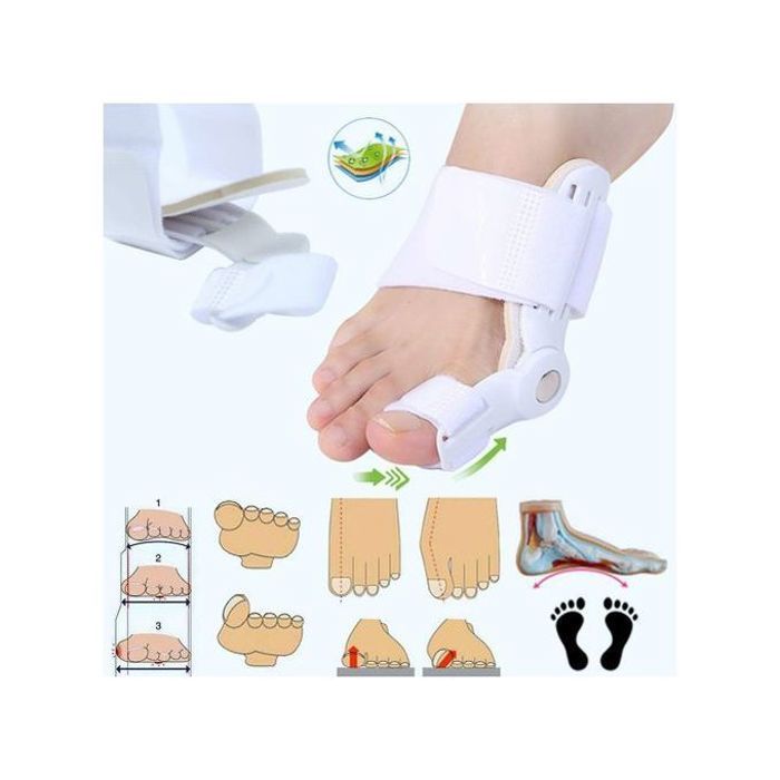 Orthèse Hallux Valgus : Correction Efficace de l'Oignon & Soulagement de la Douleur - Haute Qualité