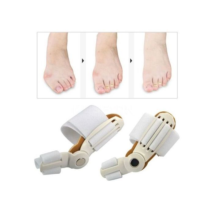 Attelle d'Hallux Valgus : Soulagement & Correction des Oignons