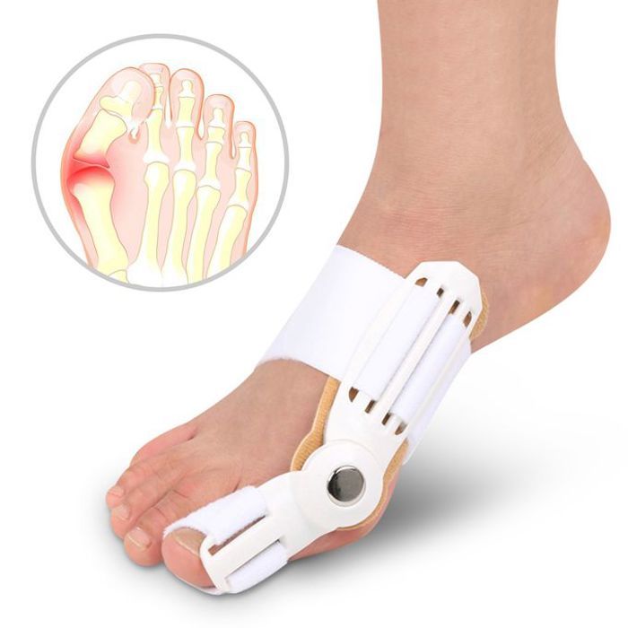 Correcteur d'Orteil Hallux Valgus : Soulagement & Correction