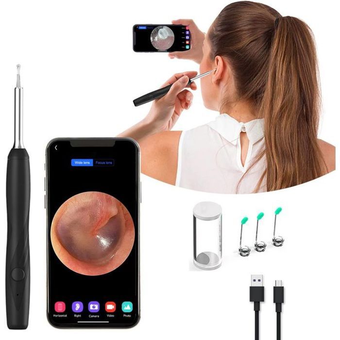 Nettoyeur d’Oreille Intelligent Camera Sans Fil – Vision HD 1296P pour un Nettoyage Précis !