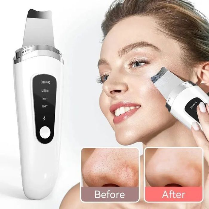 Épurateur à Ultrasons pour la Peau avec Nettoyage en Profondeur - Blanc