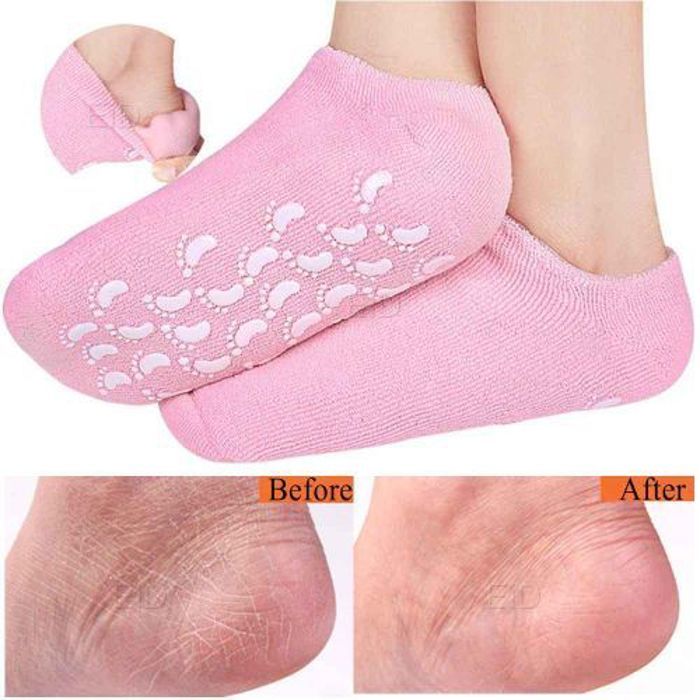 Chaussettes de gel de spa en silicone,soin des pieds, hydratant,protection de la peau fissurée-2PCS