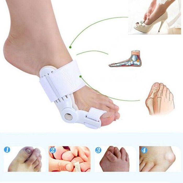 Correcteur d'hallux Valgus - Bunion - Attelle de gros orteil - Soulagement de la pression - Confortable - Mixte