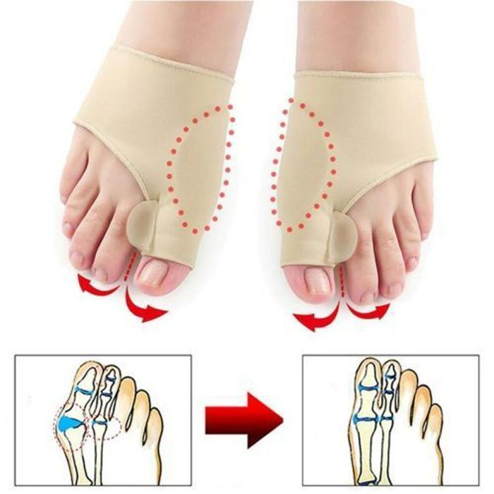 Correcteur d'orteils - Non spécifié - Hallux Valgus - 2 pièces - Gel doux - Tissu flexible