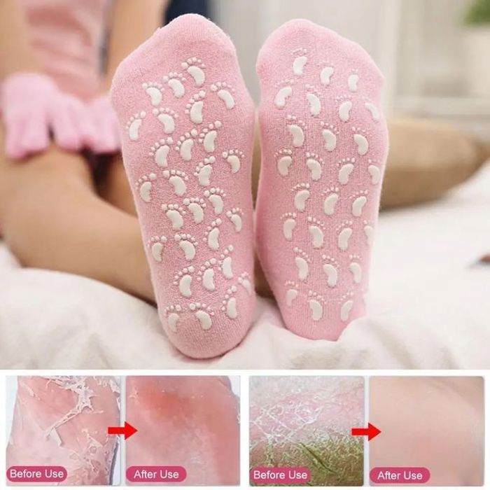 Chaussettes réutilisable en gel, chaussettes en silicone, hydratantes, exfoliantes, enlever peau morte, soin pieds secs MULTICOLORS