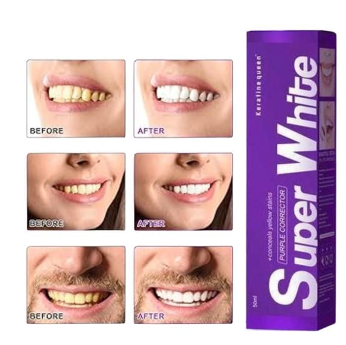 NOUVEAU - Dentifrice blancheur - blanchiment des dents instantanées