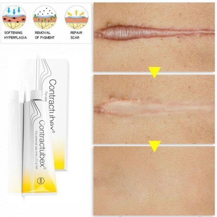 Contractubex Gel 20 g – Élimine les Cicatrices, Adoucit et Lisse la Peau
