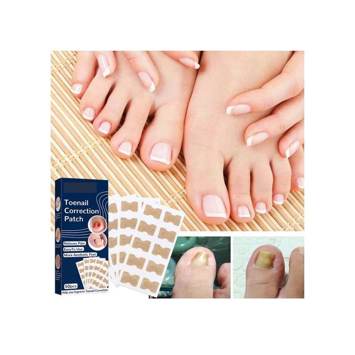 Patch Correcteur d'Ongles, Pour Ongles Sains et Soulagement de la Douleur, 50Pcs