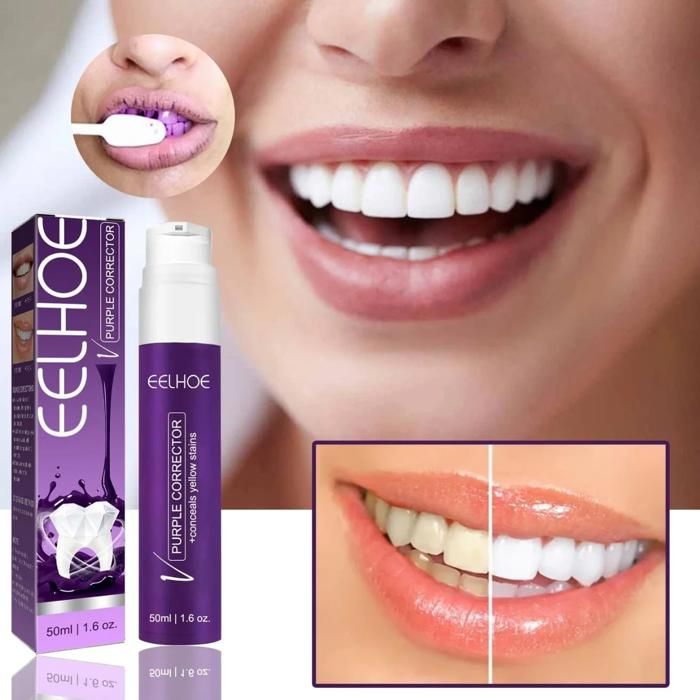 LE PURPLE CORRECTOR : Blanchissement Dentaire .