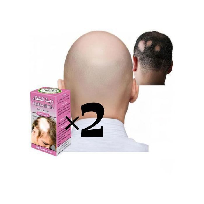 Herbo Ridouane Huile El Chifae 30ml
